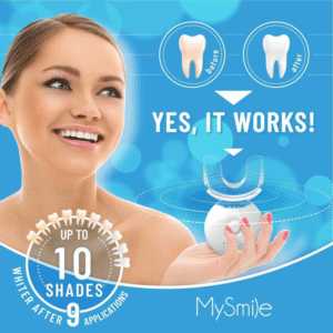 MySmile Teeth Whitening Kit with LED Light, 10 Min Non-Sensitive Fast Teeth Whitener